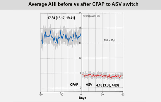 grafiek met ASV big data met uren PAP-gebruik voor vs na CPAP naar ASV wissel